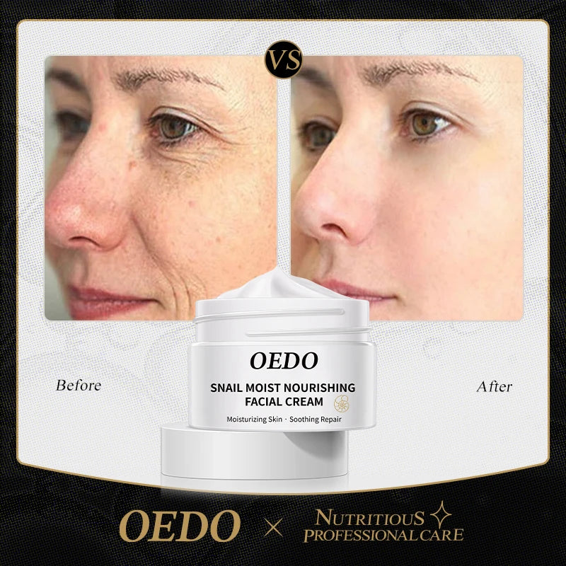 OEDO Anti-aging Anti-wrinkle Whitening Moisturizing Face Nourishing Skin Care Cream
